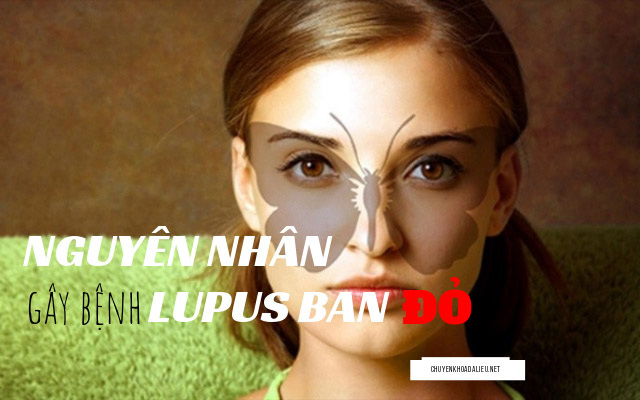 nguyên nhân gây bệnh Lupus ban đỏ