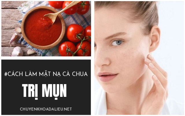 mặt nạ cà chua trị mụn1