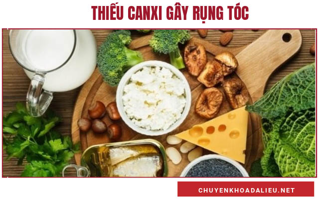 rụng tóc nhiều là do thiếu chất gì3