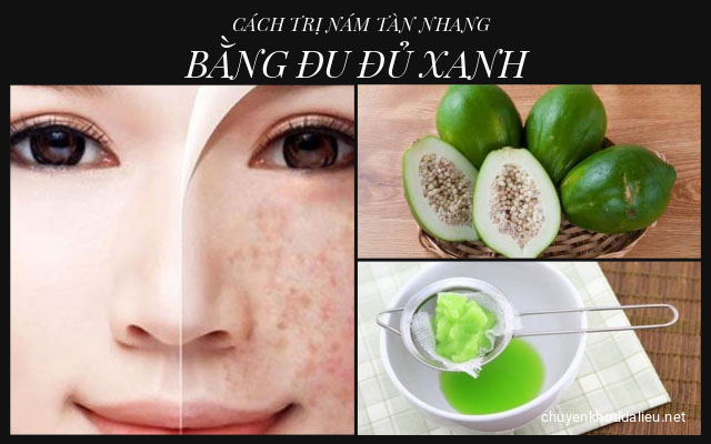 CÁCH TRỊ NÁM TÀN NHANG BẰNG ĐU ĐỦ XANH