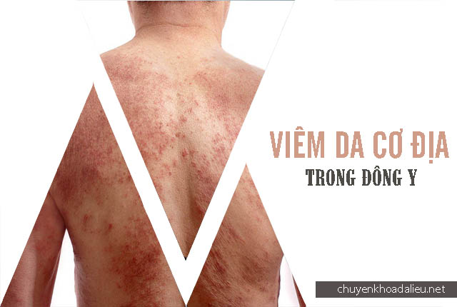 viêm da cơ địa trong đông y