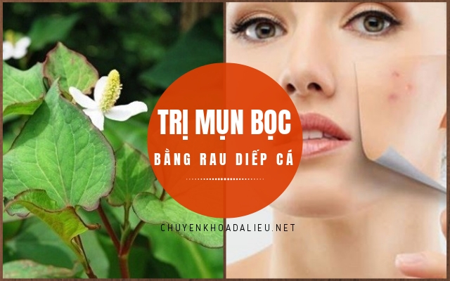 Trị mụn bọc bằng rau diếp cá