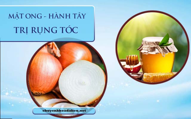 trị rụng tóc bằng mật ong và hành tây