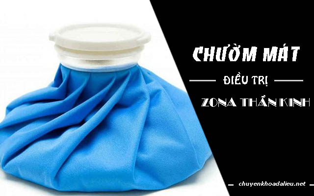 chườm mát chữa zona thần kinh