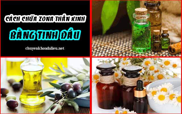 tinh dầu điều trị zona thần kinh