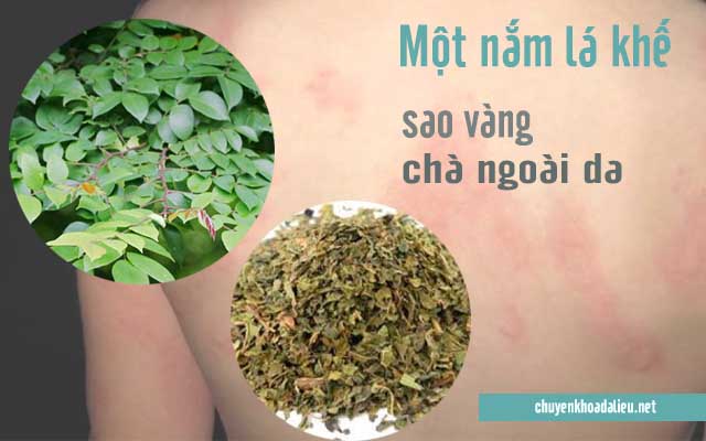 Dùng lá khế sao vàng để trị bệnh mề đay hiệu quả