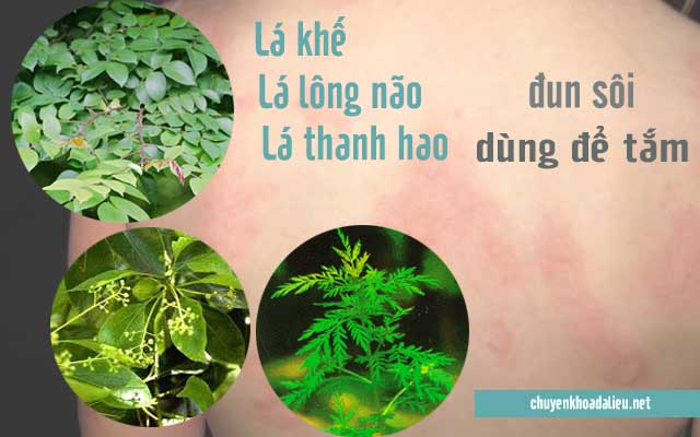 Lá khế cùng một số dược liệu khác để chữa mề đay 