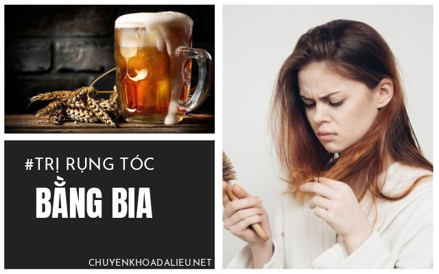 trị rụng tóc bằng bia