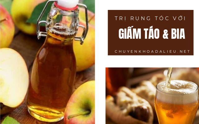 trị rụng tóc bằng bia và giấm táo