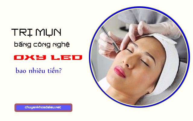 Chi phí trị mụn bằng công nghệ Oxy Led