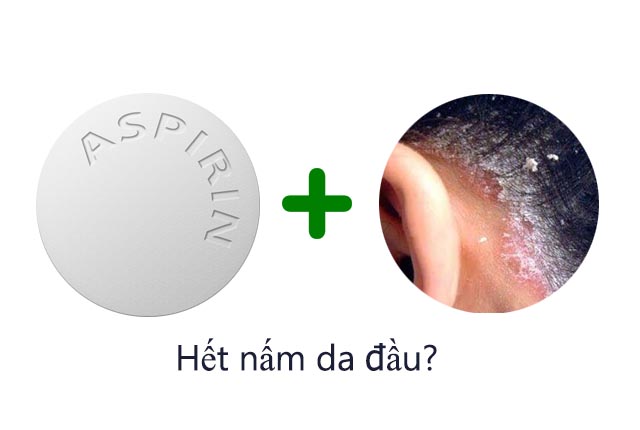 Aspirin trị nấm da đầu?