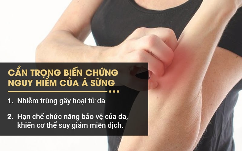 Biến chứng của bệnh á sừng