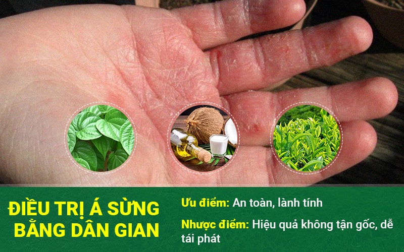 Chữa á sừng bằng cách dân gian