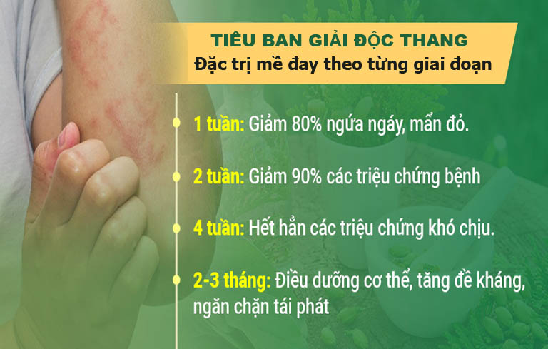 Tiêu ban Giải độc thang điều trị mề đay hiệu quả cao và toàn diện