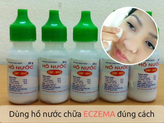 Thuốc trị bệnh eczema hiệu quả
