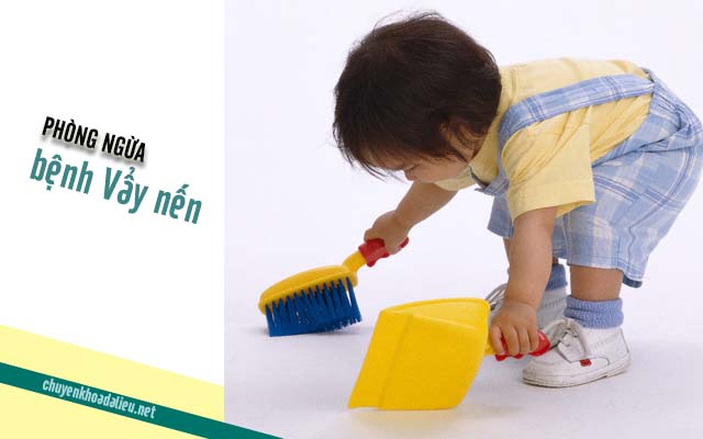 những biện pháp phòng chống bệnh vẩy nến