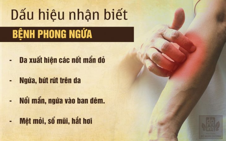 Triệu chứng bệnh phong ngứa thường gặp