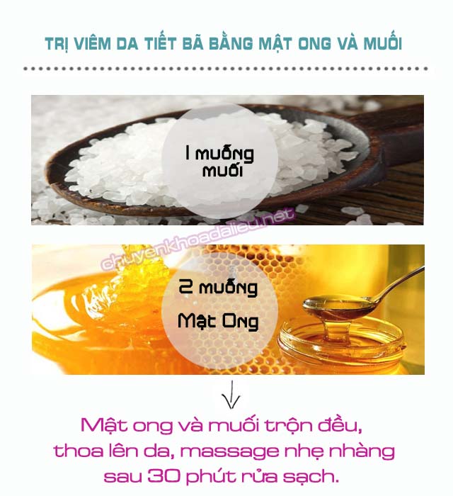 Mẹo chữa viêm da tiết bã bằng mật ong