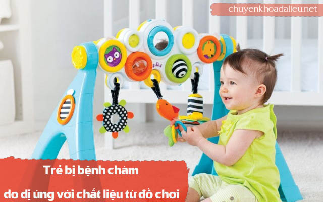 dị ứng đồ chơi là nguyên nhân gây bệnh chàm ở trẻ em