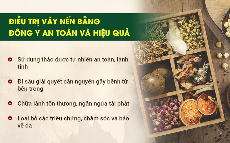 Chữa vảy nến bằng Đông y