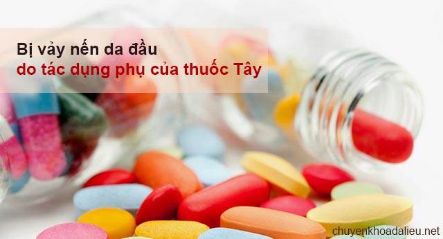 Dùng thuốc tây không đúng cách là nguyên nhân gây bệnh vẩy nến da đầu