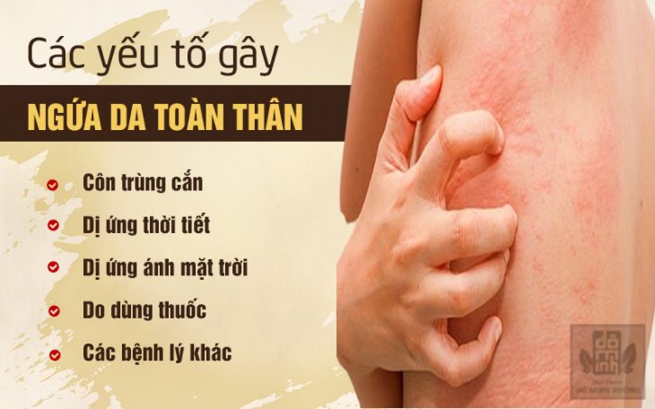 Các yếu tố dẫn đến ngứa da toàn thân về đêm