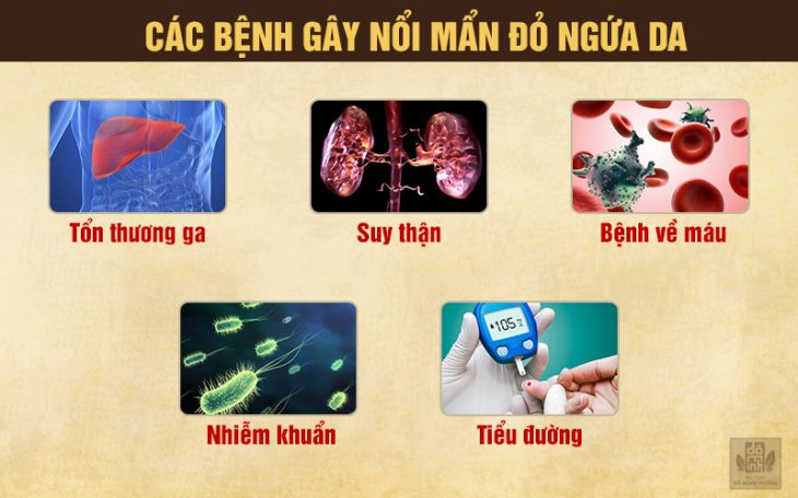 Bệnh lý bên trong gây nổi mẩn đỏ ngứa da