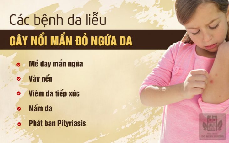 Các yếu tố dẫn đến đến nổi mẩn đỏ ngứa da