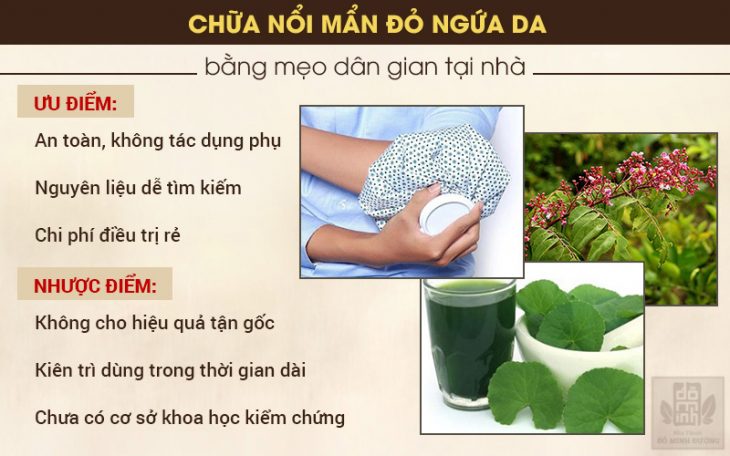 Ưu nhược điểm phương pháp dân gian chữa nổi mẩn đỏ