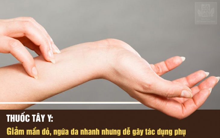 Không lạm dụng thuốc tây chữa nổi mẩn đỏ mề đay