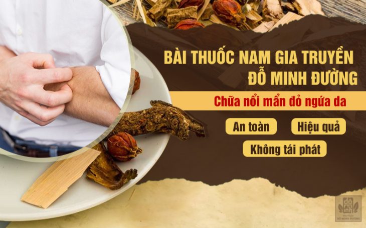 Bài thuốc gia truyền 5 đời chữa nổi mẩn đỏ ngứa da