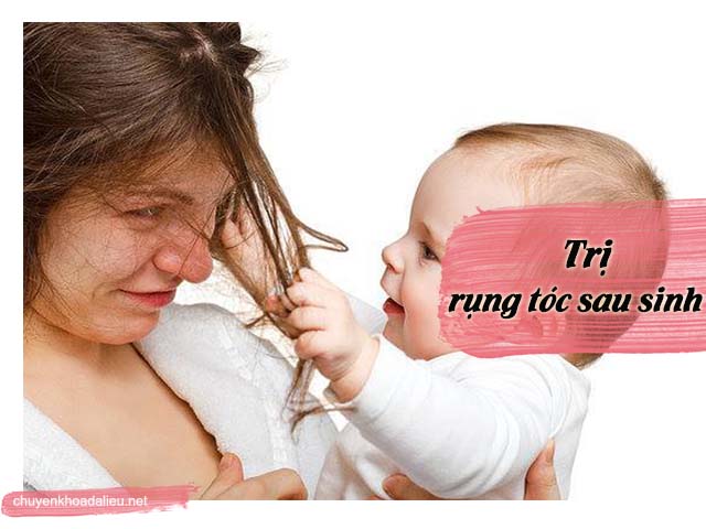 chữa trị rụng tóc sau sinh