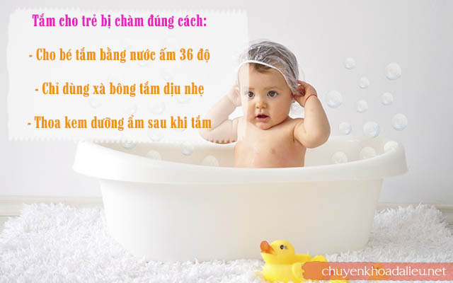 Tắm đúng cách giúp hỗ trợ điều trị bệnh chàm ở trẻ em