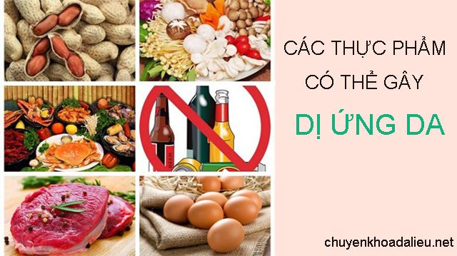 Các thực phẩm có thể gây dị ứng da