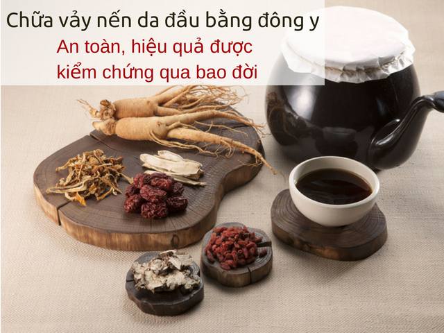 Cách chữa vẩy nến trên da đầu bằng thuốc Đông y