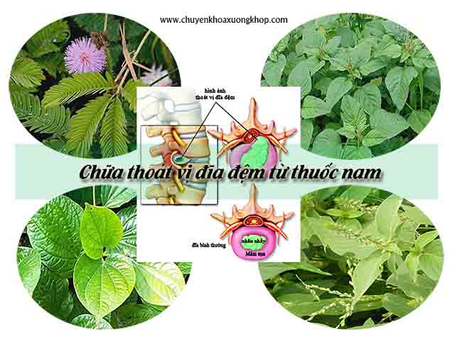 chữa thoát vị đĩa đệm bằng thuốc nam.