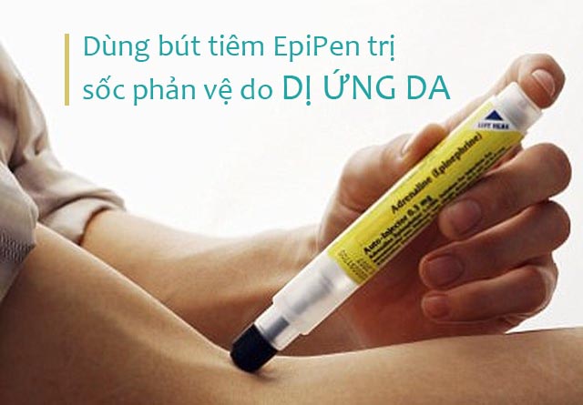 Cách chữa dị ứng da bằng bút tiêm EpiPen