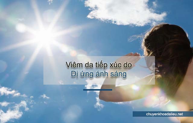 viêm da tiếp xúc do dị ứng ánh sáng