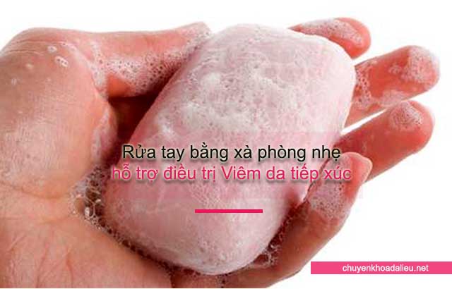 những lưu ý khi bị viêm da tiếp xúc