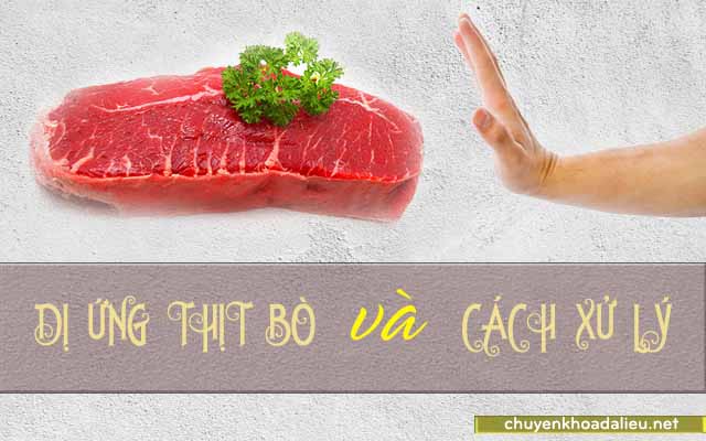 Dị ứng với thịt bò và cách giải quyết