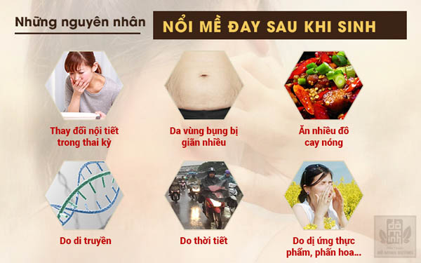 Những nguyên nhân nổi mề đay sau sinh