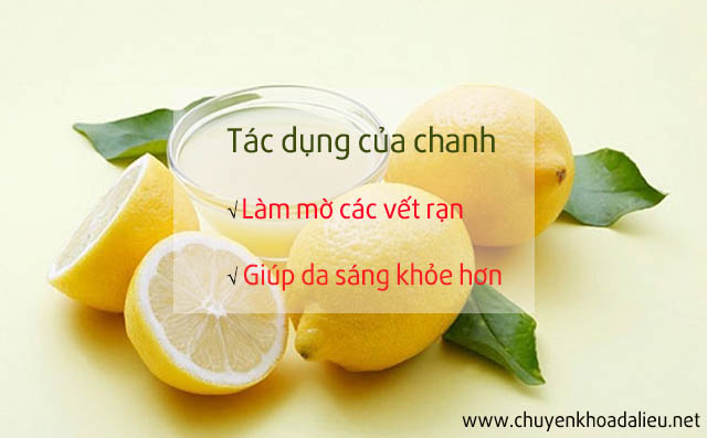 mẹo trị rạn da sau sinh bằng chanh