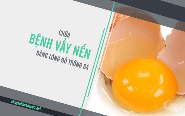 Chữa bệnh vẩy nến bằng lòng đỏ trứng gà 