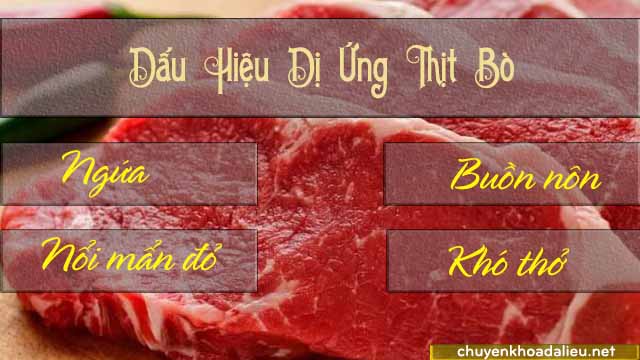 Một vài dấu hiệu nhận biết cơ thể dị ứng với thịt bò