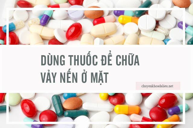 thuốc chữa vảy nến ở mặt