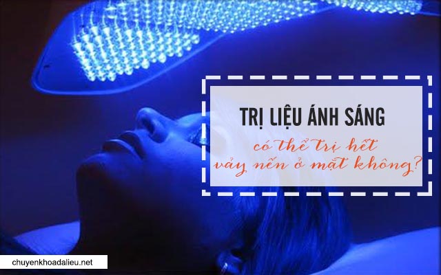 trị liệu ánh sáng