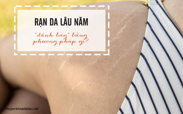 rạn da lâu năm