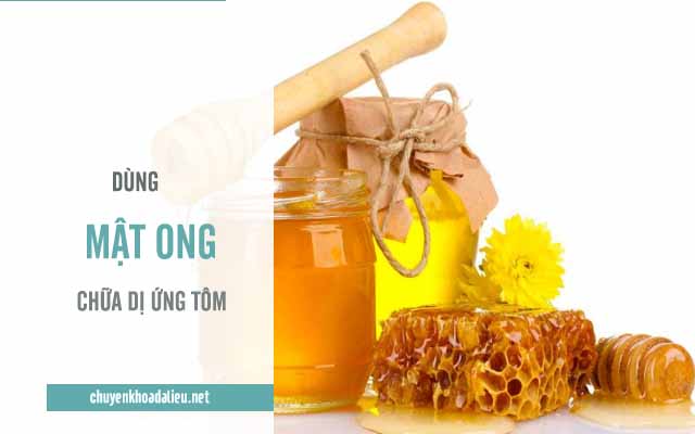 dùng mật ong chữa dị ứng tôm