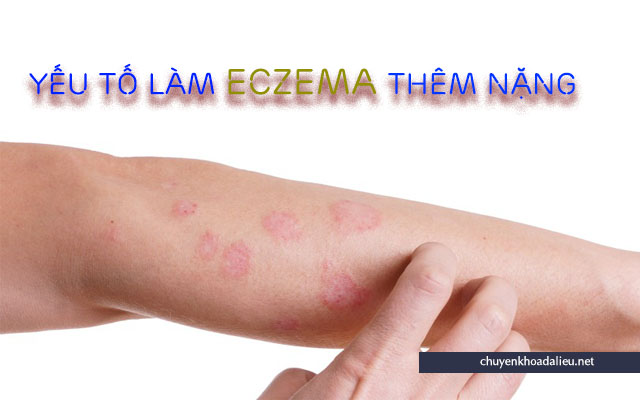 Một số yếu tố có thể làm bệnh eczema thêm nặng