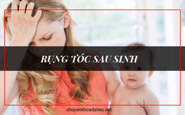 nguyên nhân gây rụng tóc sau sinh